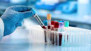 Lab Test's